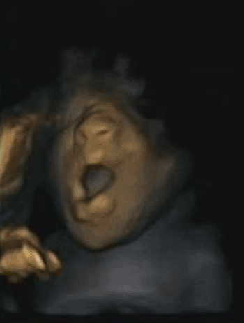 Image: A fetus yawning in the womb (Photo courtesy of Durham University).